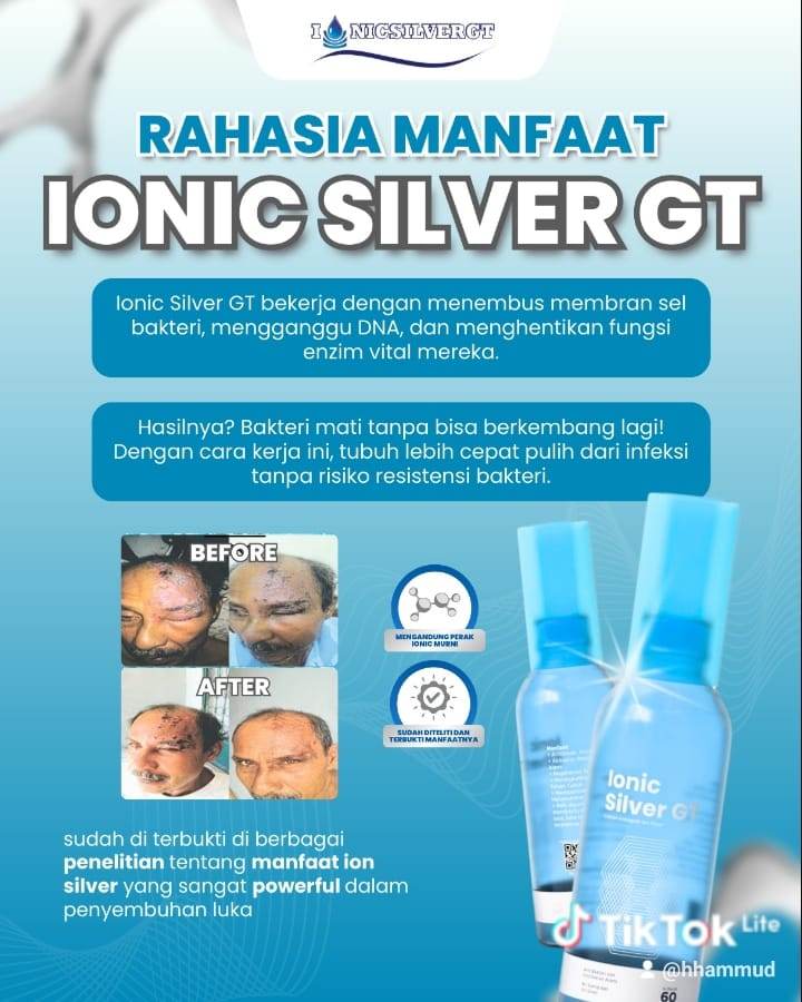 IONIC SILVER GT